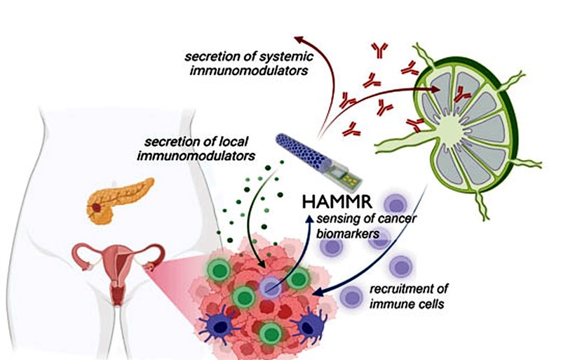 Slika ilustrira kako će se implantat "zatvorene petlje" nazvan HAMMR koristiti za liječenje raka jajnika. Implantat, dovoljno malen da se može ugraditi minimalno invazivnom operacijom, razvija tim istraživača sa Sveučilišta Rice 📷 Veiseh Lab / Rice University