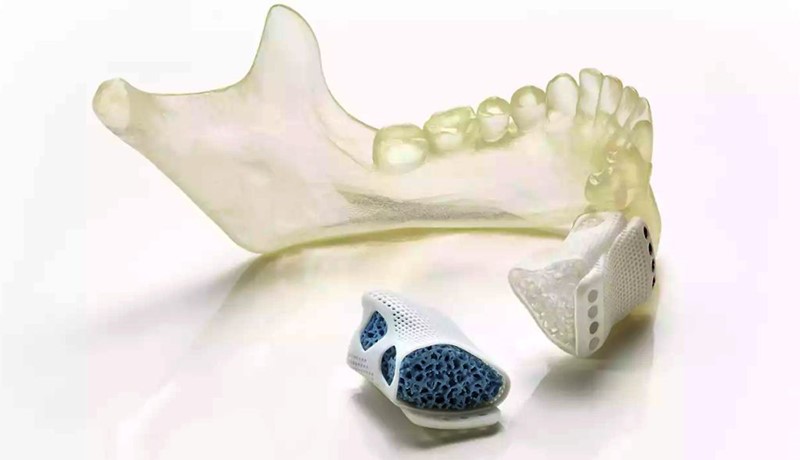 Personalizirani 3D-ispisani koštani keramički implantat donje čeljusti  📷 Lithoz