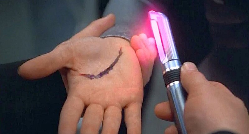 Dermal Regenerator, futuristička spravica iz serijala Star Trek danas više nije toliko daleka budućnost 📷 Paramount Global