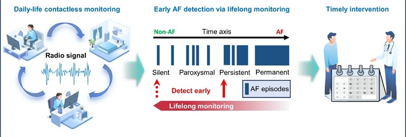 Pregled sustava i njegov potencijal za cjeloživotno praćenje atrijalne fibrilacije 📷 Yan Chen i sur.