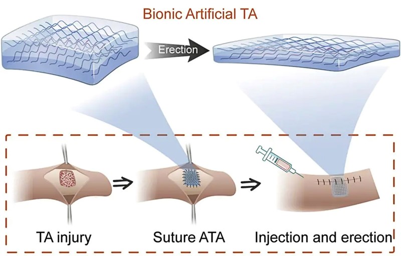 Bionički penis: sintetičko tkivo obnavlja erektilnu funkciju Bionicki-penis-sinteticko-tkivo-obnavlja-erektilnu-funkciju_xoFBfp