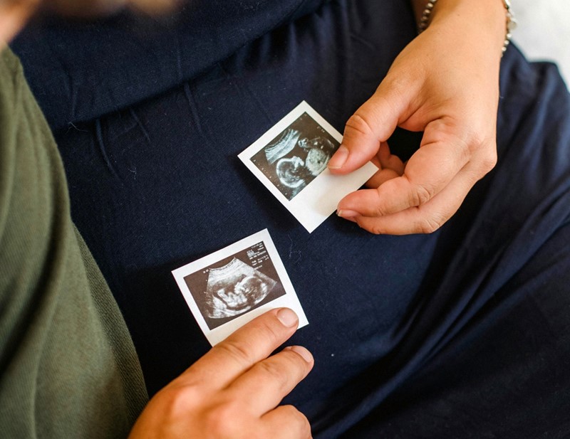 Demografski podijeljen svijet imat će goleme posljedice za gospodarstva i društva 📷 Pexels