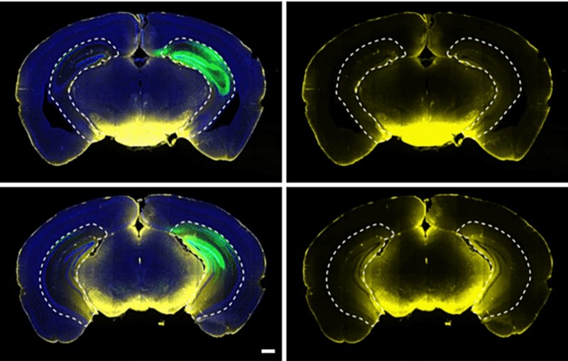 Skeniranje mozga miševa otkrilo je neuronsku aktivnost i proces čišćenja mozga 📷 Jiang-Xie i sur.