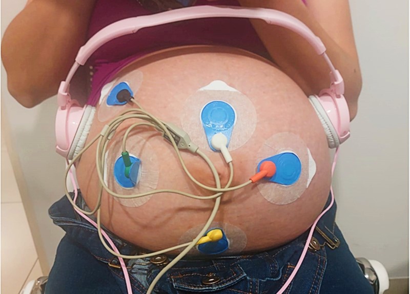 Tijekom eksperimenta na trbuh su  postavljene elektrode i bipolarni detekcijski kanali 📷 Claudia Lerma i sur.