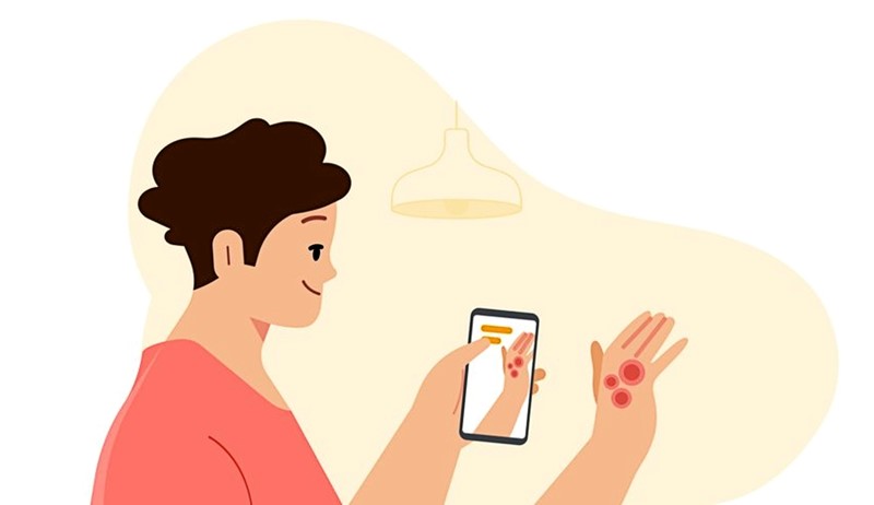 Google je predstavio i dijagnostičku umjetnu inteligenciju za kožna oboljenja