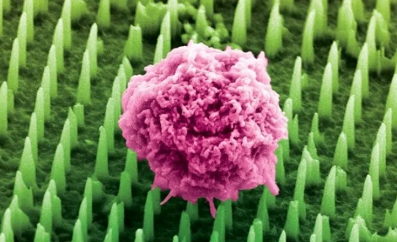 Nanoigle su 1000 puta tanje od ljudske dlake, ne uklanjaju tkivo i ne uzrokuju bol ili oštećenja 📷 KCL