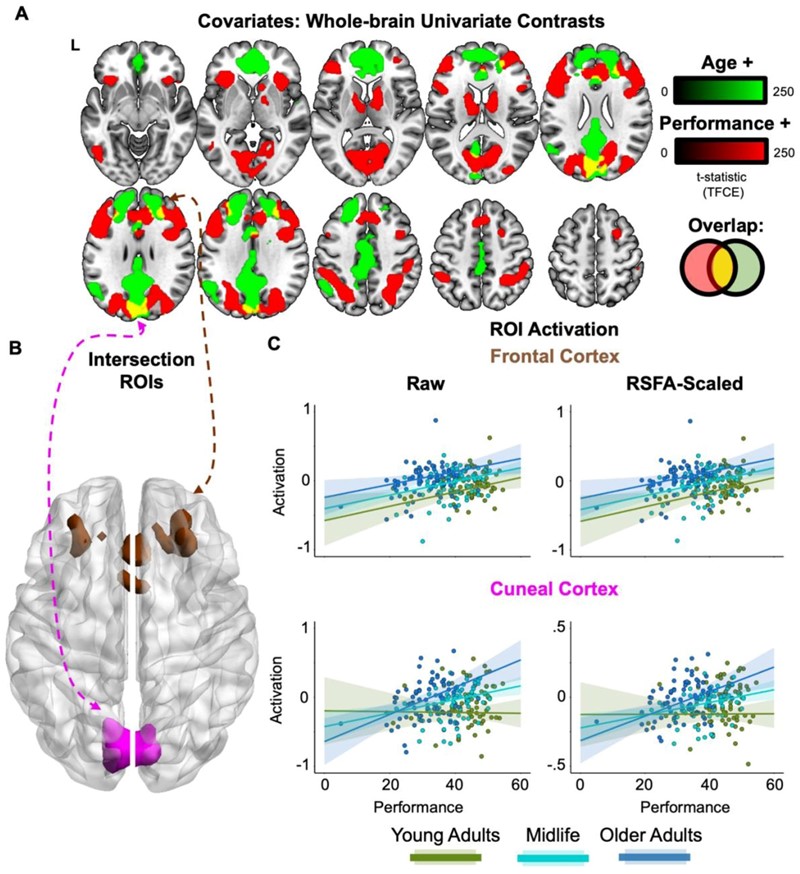 Učinak starenja na performanse ljudskog mozga 📷 University of Cambridge