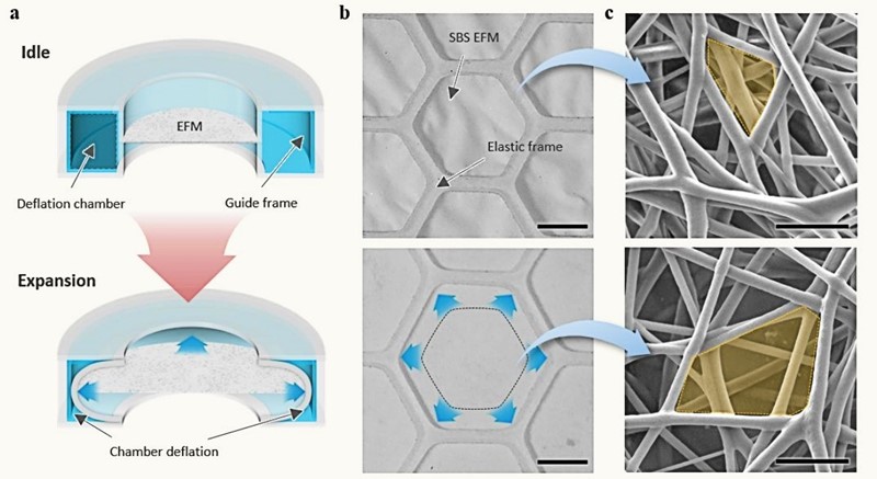 AI softver omogućuje respiratoru da se prilagodi jedinstvenim respiratornim karakteristikama pojedinaca