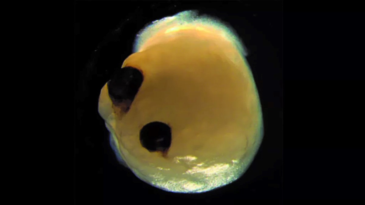 Moždani organoid srastao s rudimentarnim optičkim