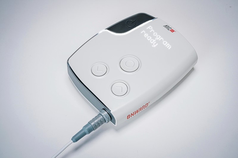 ARC-EX, uređaj koji leđnoj moždini isporučuje električnu struju 📷 ONWARD Medical N.V.