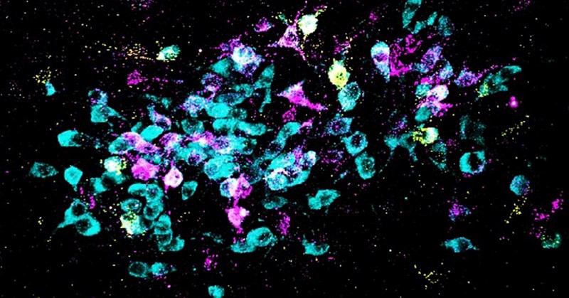 Istraživanje identificira biokemiju mozga i neuronske sklopove koji uzrokuju generalizirana iskustva straha: neuroni su prikazani u cijan boji, a retrogradni tragovi u žutoj i magenta boji 📷 Spitzer Lab, UC San Diego