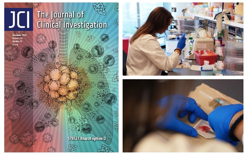Hulumtimi i publikuar në Journal of Clinical Investigation zbulon një lidhje befasuese midis infeksionit Covid dhe regresionit të kancerit 📷 Northwestern Medicine
