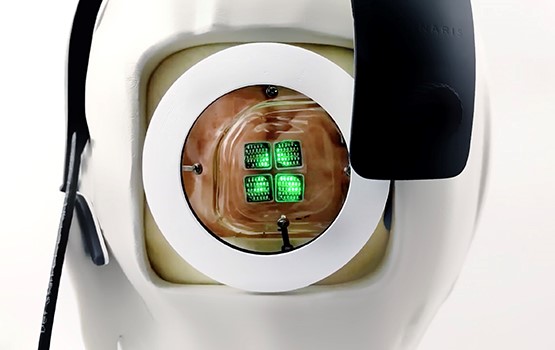 Model sustava Gennaris: oglavna kapa s kamerom i presjek kroz moždane regije s prikazom mjesta implantacije mikroelektroda