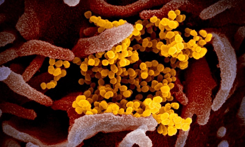 SARS-CoV-2 snimljen je ranije ove godine elektronskim mikroskopom