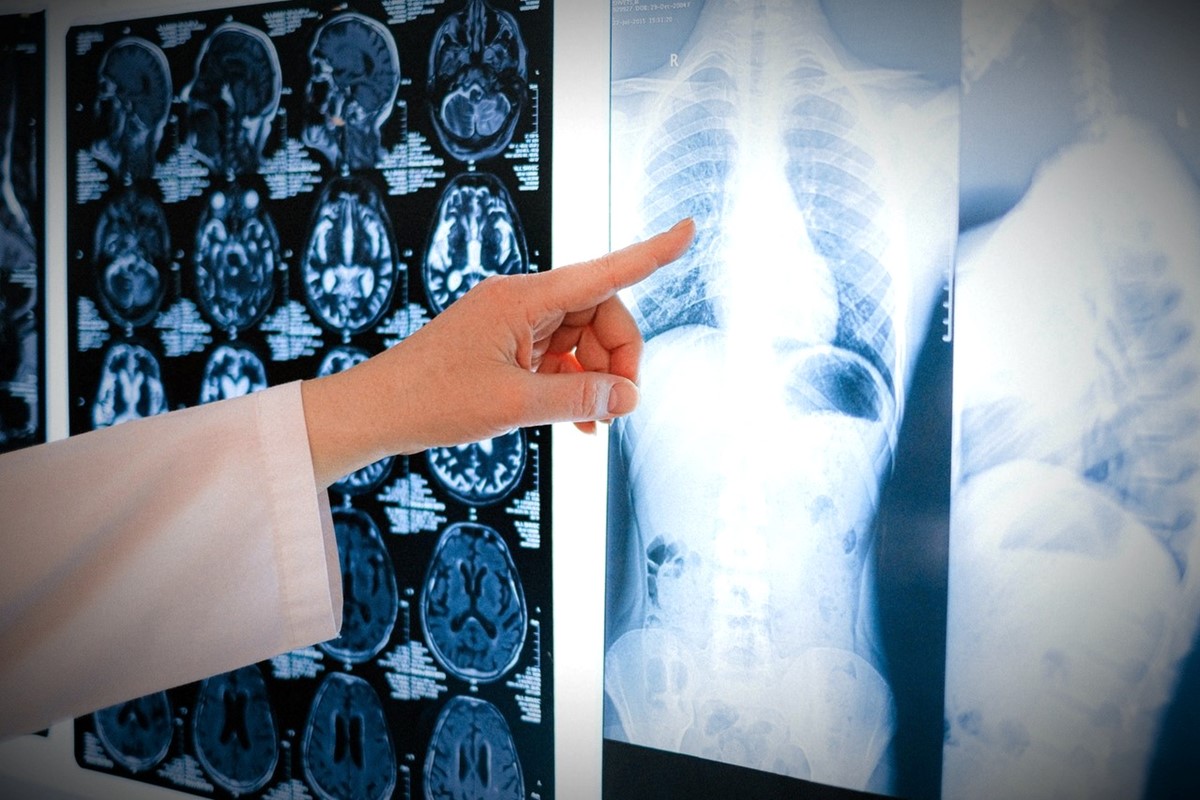 Umjetna inteligencija pogađa koje ste rase na temelju vaših rendgenskih snimaka Umjetna-inteligencija-pogadja-koje-ste-rase-na-temelju-vasih-rendgenskih-snimaka_4cScso
