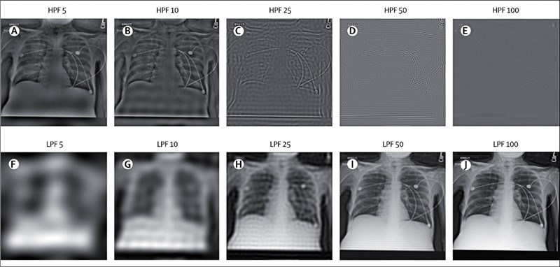 Umjetna inteligencija pogađa koje ste rase na temelju vaših rendgenskih snimaka Umjetna-inteligencija-pogadja-koje-ste-rase-na-temelju-vasih-rendgenskih-snimaka_JAGNX8