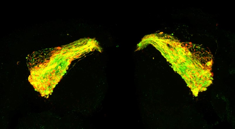 Mozak 7 dana stare vinske mušice s Tau izraženim u neuronskom krugu. Zeleno ocrtava neurone koji počinju bubriti i degenerirati zbog Tau proteina, a crveno gdje se Tau nakuplja u nakupinama duž neurona 📷 Sveučilište Southampton