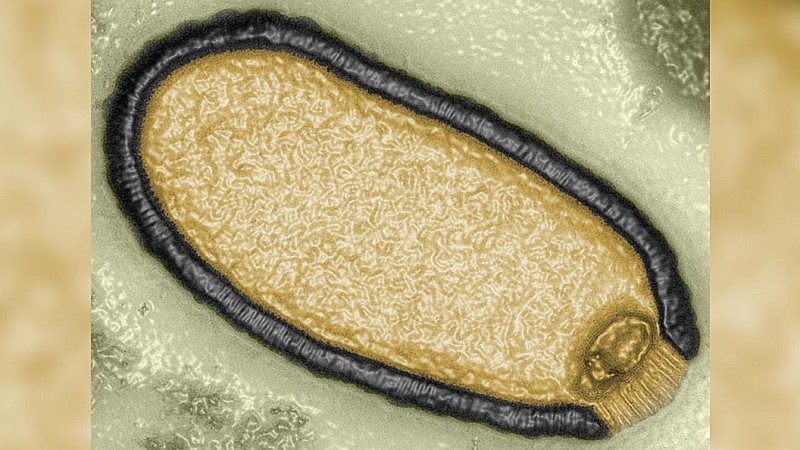 Računalno poboljšana mikrofotografija Pithovirus sibericum, izoliranog 2014. godine iz 30.000 godina starog uzorka permafrosta 📷 Jean-Michel Claverie/ IGS/ CNRS-AMU